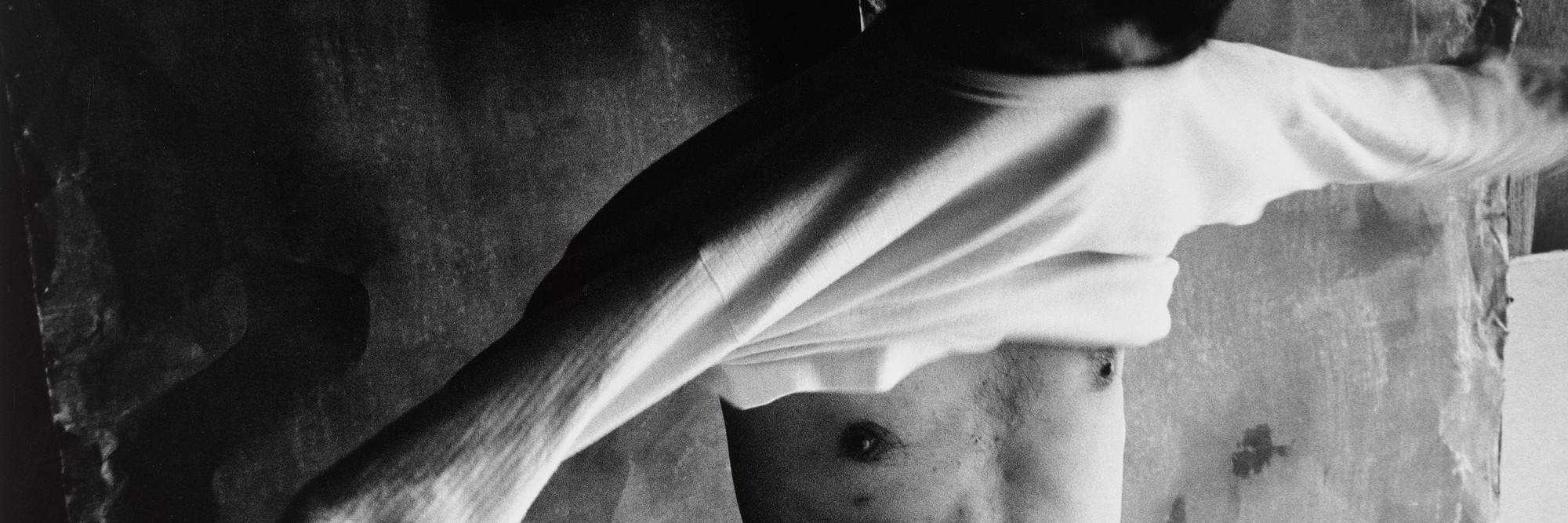 Shomei Tomatsu (Japanese, 1930-2012). Tomitarō Shimotani, Nagasaki, from the series Hibakusha. 1961. Gelatin silver print, 13 × 18 3/4" (33 × 47.6 cm). The Museum of Modern Art, New York. Gift of the artist. © 2015 Shomei Tomatsu