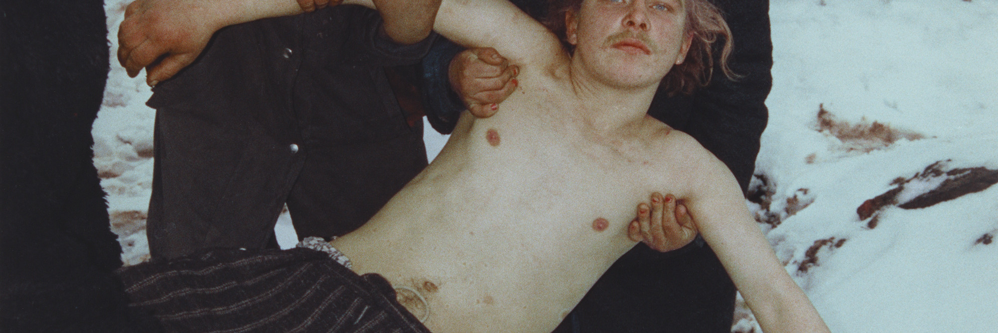 Boris Mikhailov. Untitled, from the series Case History. 1997–98. Chromogenic color print. 58 7/16 x 39 3/16" (148.5 x 99.5 cm). The Museum of Modern Art. Acquired through the generosity of Howard Stein. © 2011 Boris Mikhailov