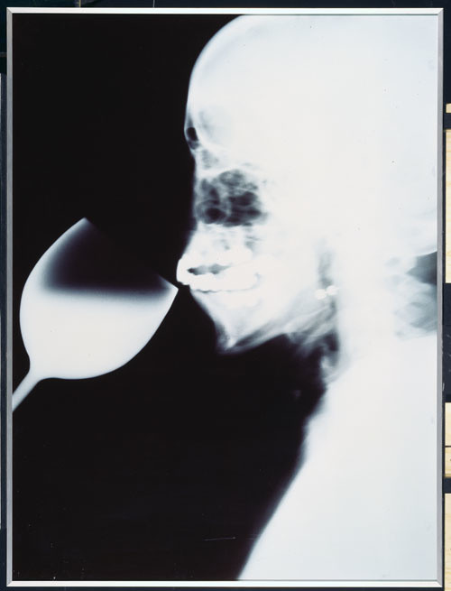 Isa Genzken. _X-Ray_ photos. 1992