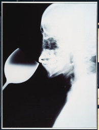 Isa Genzken. X-Ray photos. 1992