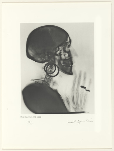 Meret Oppenheim. X-Ray of M.O.’s Skull (Röntgenaufnahme des Schädels M.O.). 1964, printed 1981