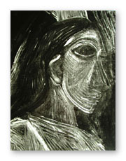 Fig.1-Curtain-Pulling Figure (far left) X-ray
