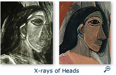 X-rays of Heads