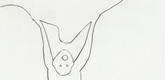 Louise Bourgeois. Jealousy Over the Breast. 2007
