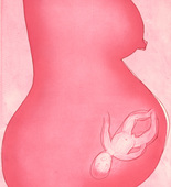 Louise Bourgeois. Pregnant Woman. 2008