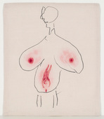 Louise Bourgeois. Untitled, no. 34 of 36, from the series, The Fragile. 2007