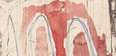 Louise Bourgeois. Untitled. 2009