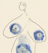 Louise Bourgeois. Untitled, no. 31 of 36, from the series, The Fragile. 2007