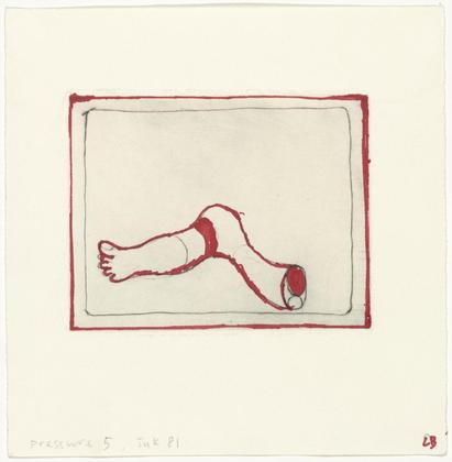 Louise Bourgeois. Hold My Bones. 2002