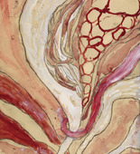 Louise Bourgeois. Tourbillon (#1). 2008