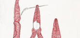 Louise Bourgeois. La R&eacute;paration, plate 3 of 7, from the portfolio, La R&eacute;paration. 2001