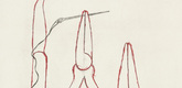 Louise Bourgeois. La R&eacute;paration, plate 3 of 7, from the portfolio, La R&eacute;paration. 2001