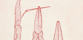 Louise Bourgeois. La R&eacute;paration, plate 3 of 7, from the portfolio, La R&eacute;paration. 2001