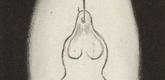 Louise Bourgeois. Hanging Figure. 2000