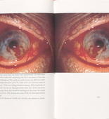Louise Bourgeois. Untitled, no. 8 of 8, from Homely Girl, A Life, volume II. 1992