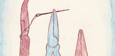 Louise Bourgeois. La R&eacute;paration, plate 3 of 7, from the portfolio, La R&eacute;paration. 2001