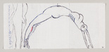 Louise Bourgeois. Arch of Hysteria (double-sided). 1992
