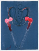 Louise Bourgeois. Untitled. 1987