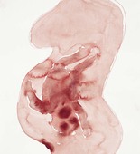 Louise Bourgeois. Pregnant Woman. 2009