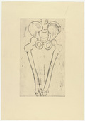 Louise Bourgeois. Untitled, plate 8 of 12, from the portfolio, Anatomy. 1989